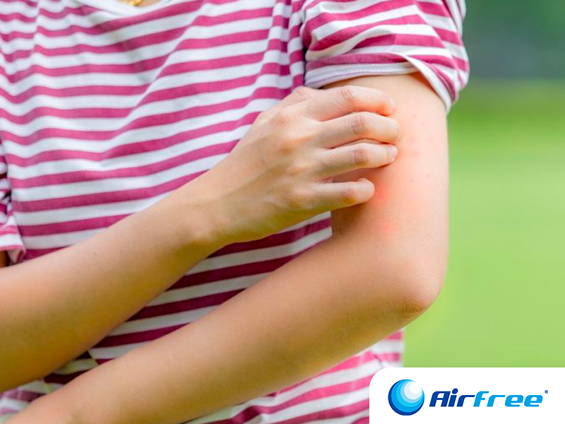 Alergias al poliéster: síntomas, factores causantes y consejos